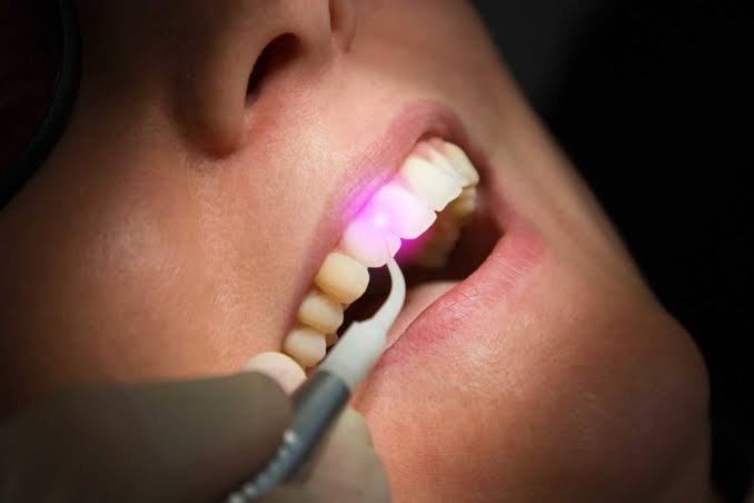 Shining a Light on Laser Dentistry: A Gentle Touch for Your Smile